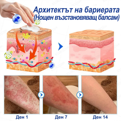 KUBOZN® Псориазис Дневна и Нощна Възстановяваща Система – 100% Без Стероиди Дуо за Облекчение при Плаки, Лющене и Сърбеж