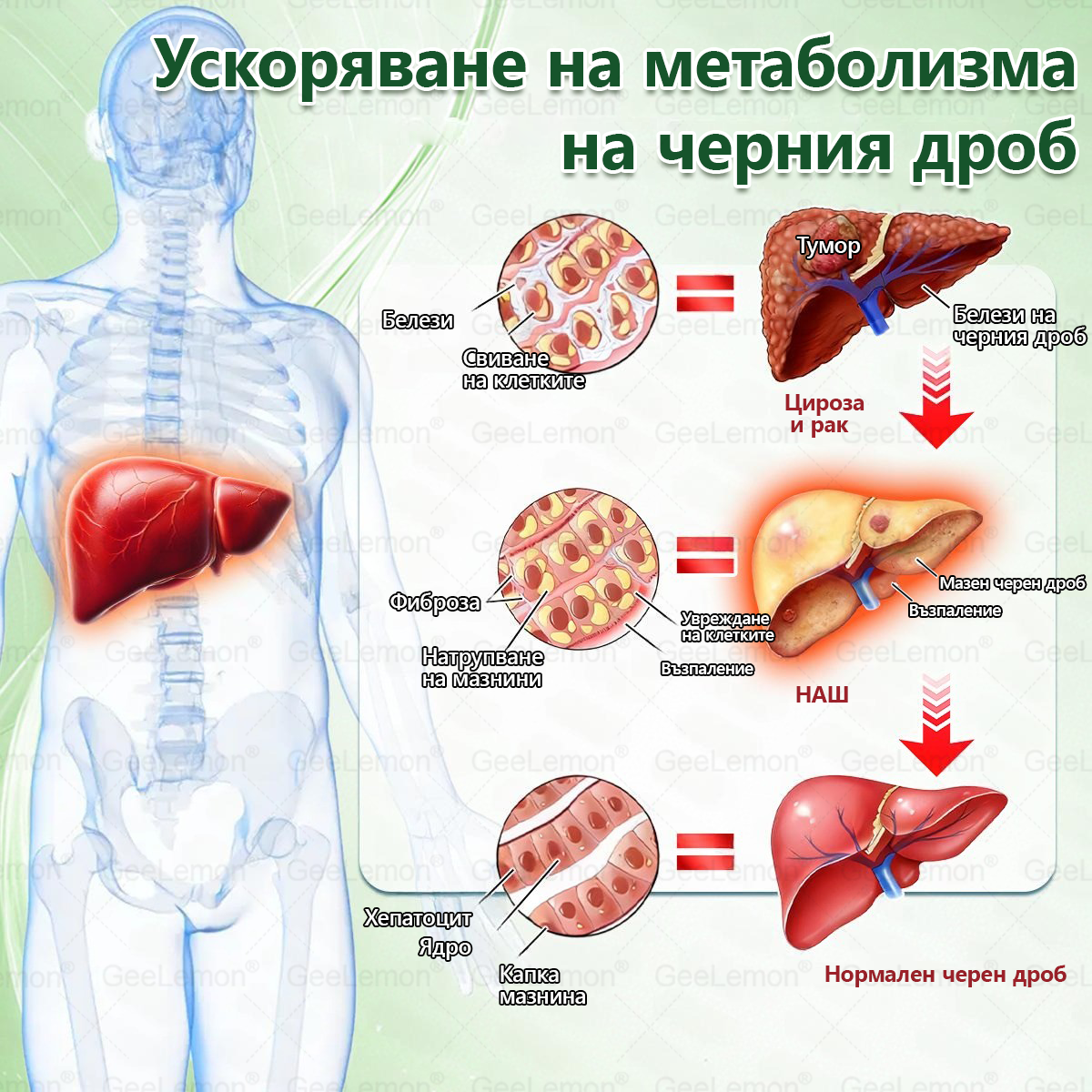✅Официален магазин 👩‍⚕️ 𝐆𝐞𝐞𝐥𝐞𝐦𝐨𝐧® 𝐆𝐥𝐮𝐦𝐚𝐬𝐞𝐭𝐢𝐝𝐞 𝟖 в 𝟏 – Нано микроиглен пластир за отслабване | Само 1× дневно ✅ Видими промени за 7 дни – при затлъстяване, сърдечно-съдово здраве, диабет и ставни проблеми