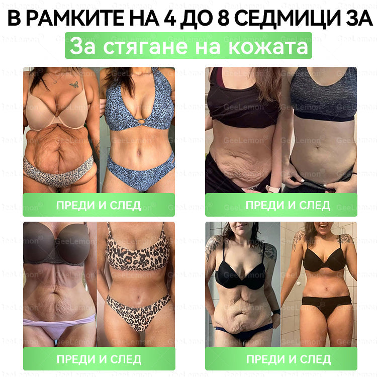 ✅Официален магазин 👩‍⚕️ 𝐆𝐞𝐞𝐥𝐞𝐦𝐨𝐧® 𝐆𝐥𝐮𝐦𝐚𝐬𝐞𝐭𝐢𝐝𝐞 𝟖 в 𝟏 – Нано микроиглен пластир за отслабване | Само 1× дневно ✅ Видими промени за 7 дни – при затлъстяване, сърдечно-съдово здраве, диабет и ставни проблеми