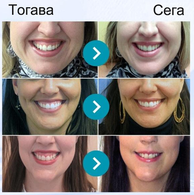 Pureluxo® VioCore паста за зъби с пчелна отрова — 🔥създадена специално за грижа за венците