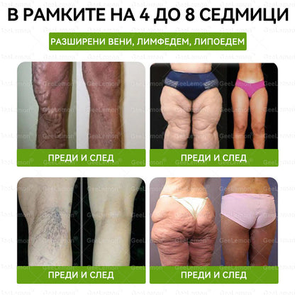 ✅Официален магазин 👩‍⚕️ 𝐆𝐞𝐞𝐥𝐞𝐦𝐨𝐧® 𝐆𝐥𝐮𝐦𝐚𝐬𝐞𝐭𝐢𝐝𝐞 𝟖 в 𝟏 – Нано микроиглен пластир за отслабване | Само 1× дневно ✅ Видими промени за 7 дни – при затлъстяване, сърдечно-съдово здраве, диабет и ставни проблеми
