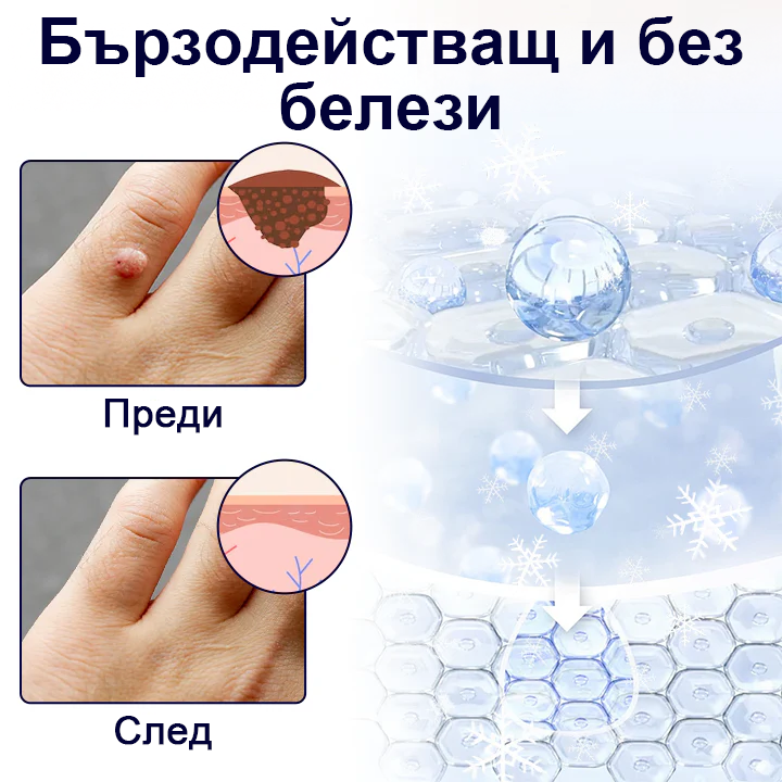 Pureluxo® WartErase Крио Спрей за Замразяване на Брадавиците