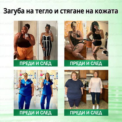✅Официален магазин 👩‍⚕️ 𝐆𝐞𝐞𝐥𝐞𝐦𝐨𝐧® 𝐆𝐥𝐮𝐦𝐚𝐬𝐞𝐭𝐢𝐝𝐞 𝟖 в 𝟏 – Нано микроиглен пластир за отслабване | Само 1× дневно ✅ Видими промени за 7 дни – при затлъстяване, сърдечно-съдово здраве, диабет и ставни проблеми