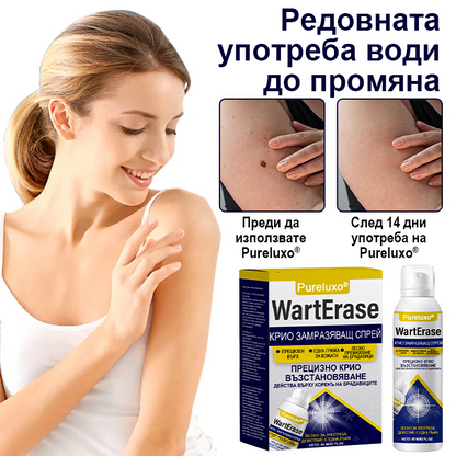 Pureluxo® WartErase Крио Спрей за Замразяване на Брадавиците