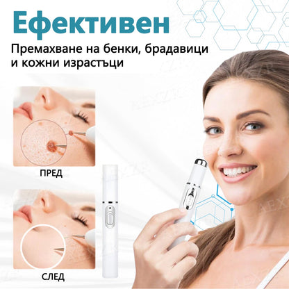 🌟Bikenda® Неинвазивна лазерна писалка за премахване на бенки и брадавици