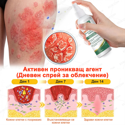 KUBOZN® Псориазис Дневна и Нощна Възстановяваща Система – 100% Без Стероиди Дуо за Облекчение при Плаки, Лющене и Сърбеж